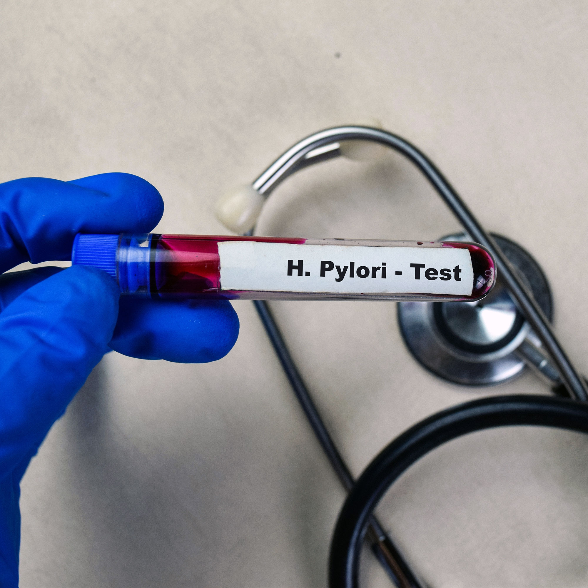 Patient Testing H.Pylori