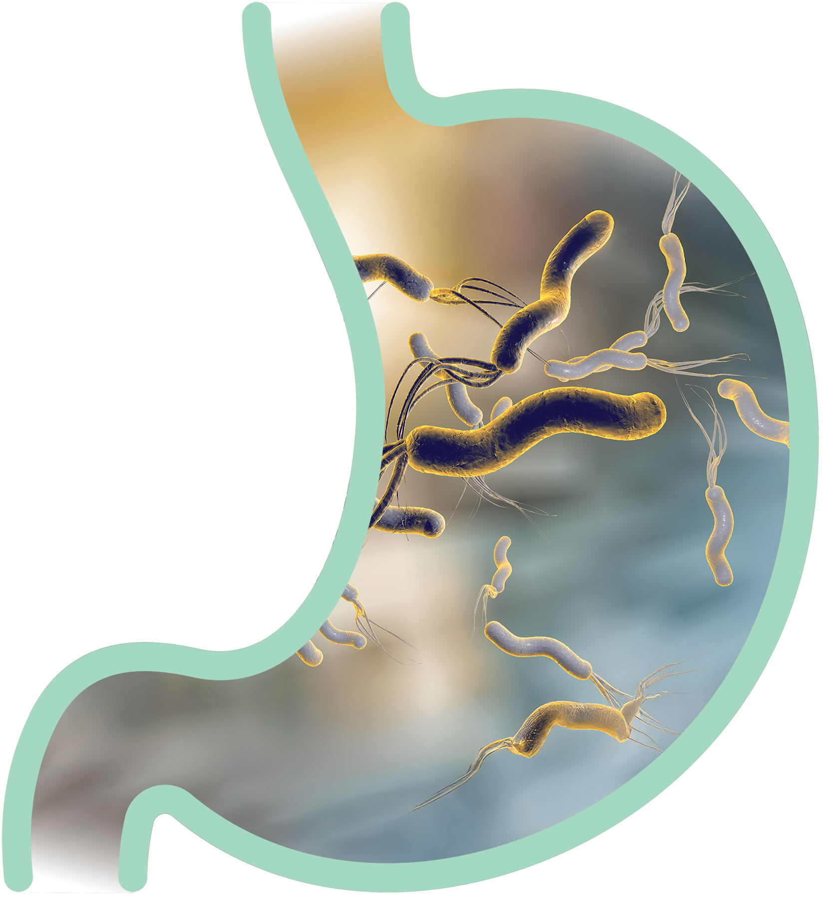 H.Pylori Bacteria in Stomach